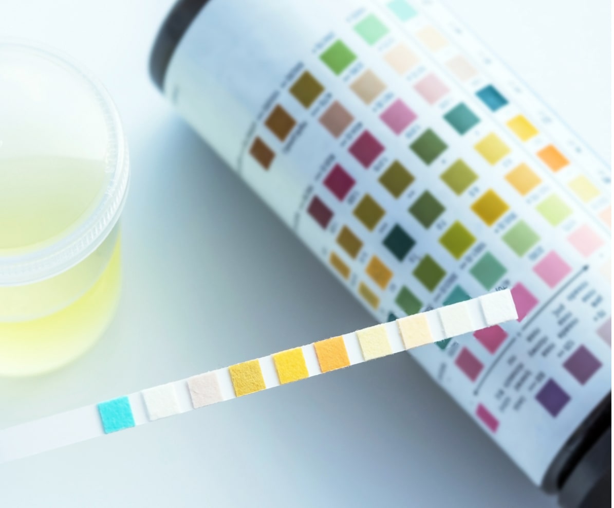 Urine testing
