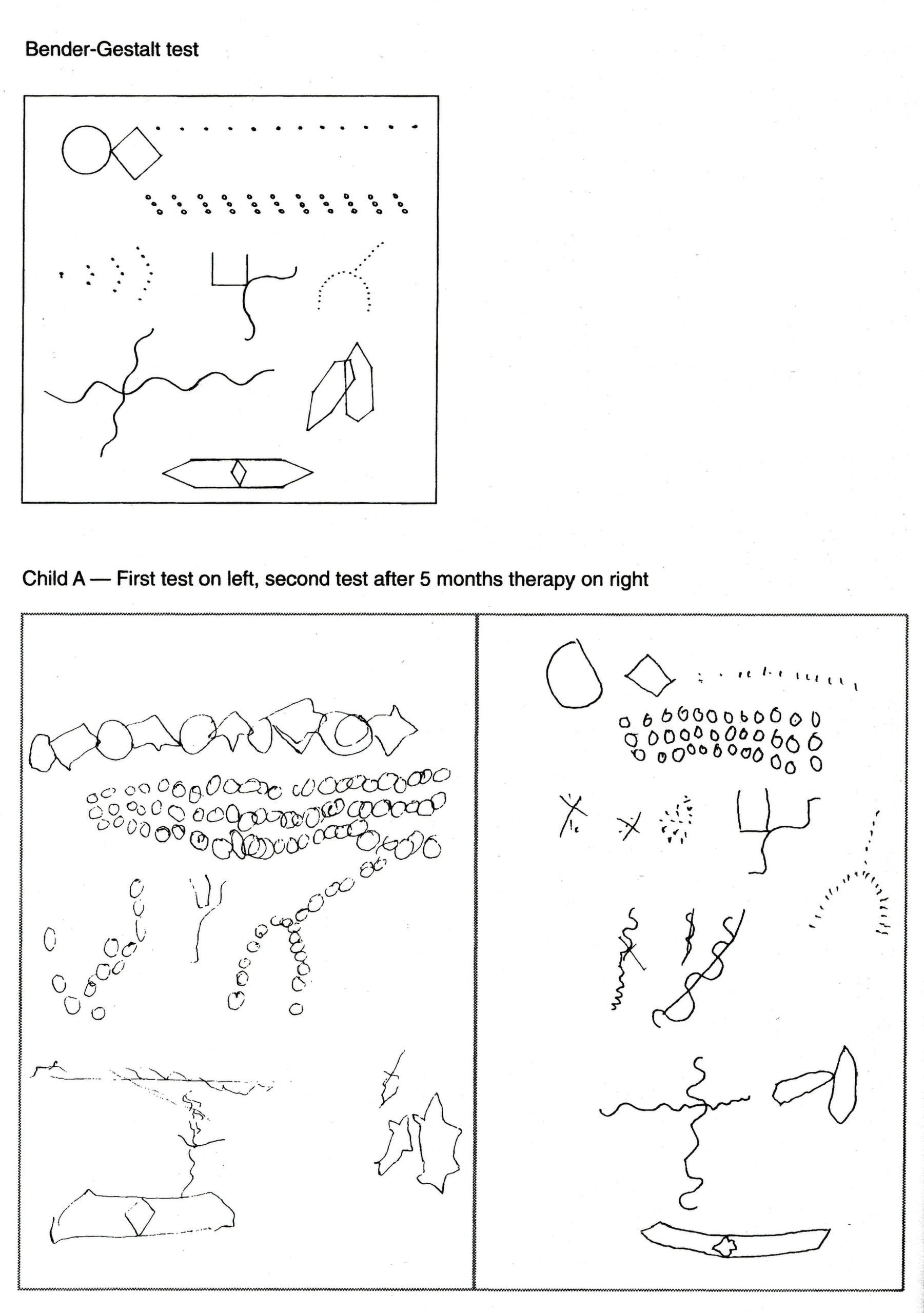 Bender-Gestalt test before and after