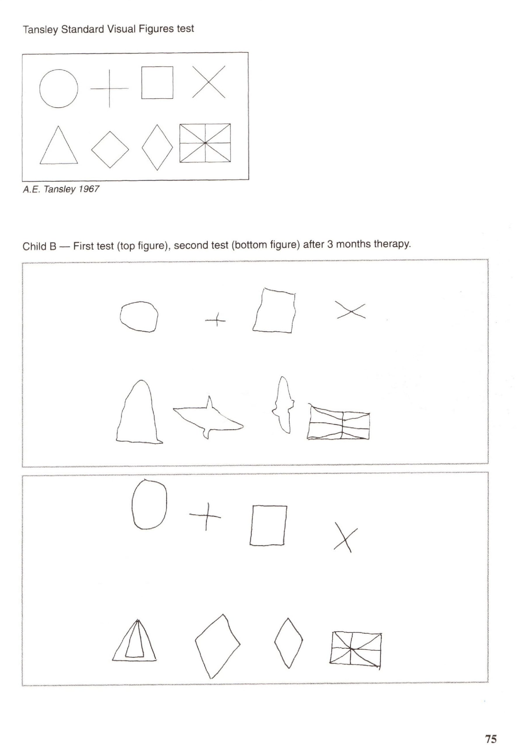 Tansley test before and after